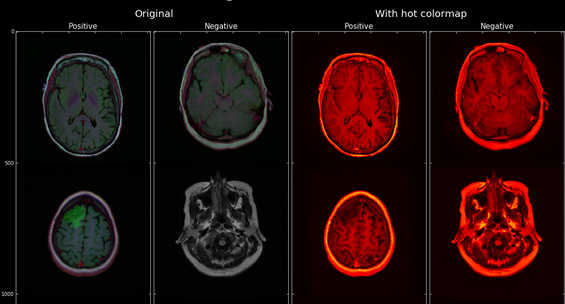 Brain Segmentation